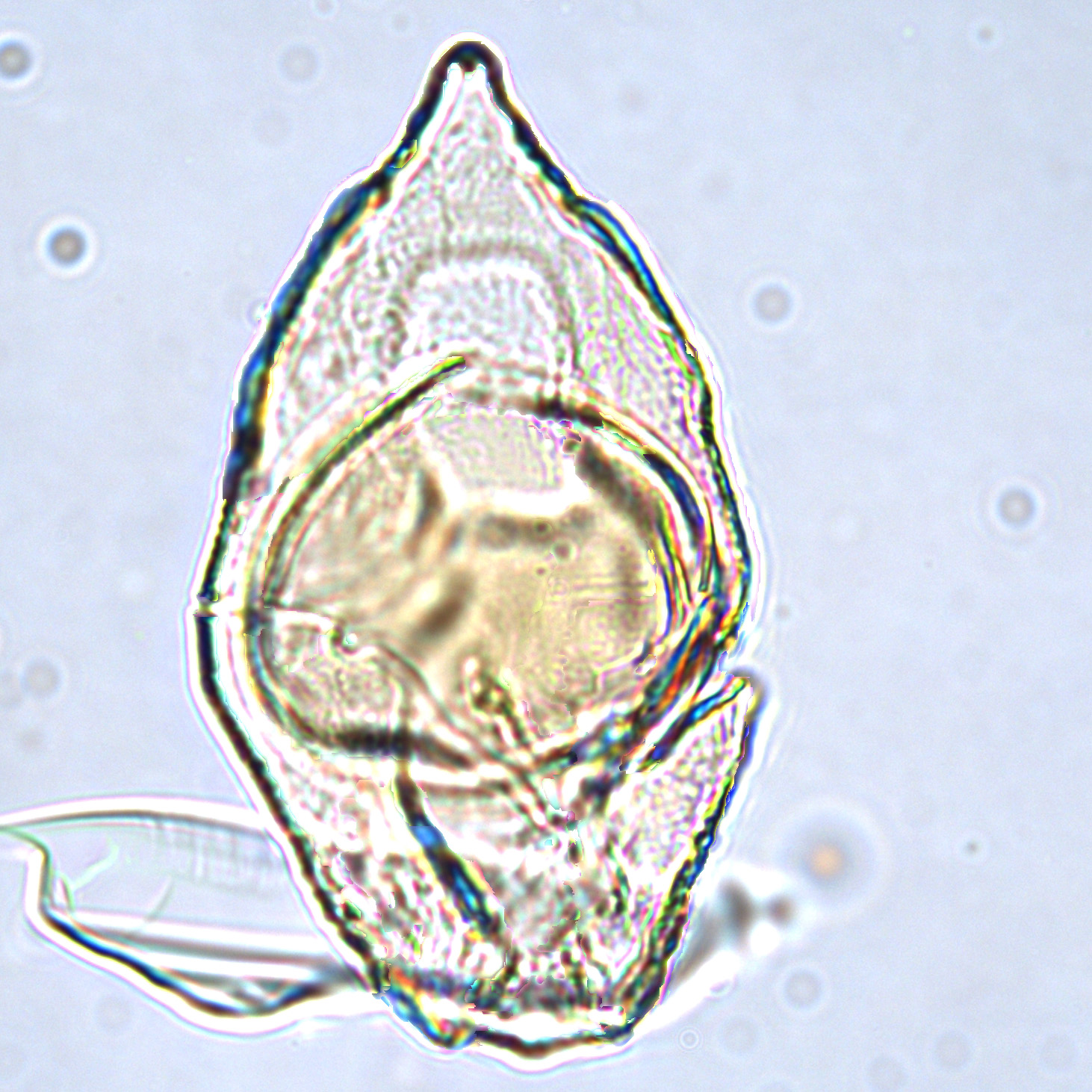 Isabelidinium bakeri, U1581-14R-1W, 89-93, sl.1, M27-3, foto3.jpg